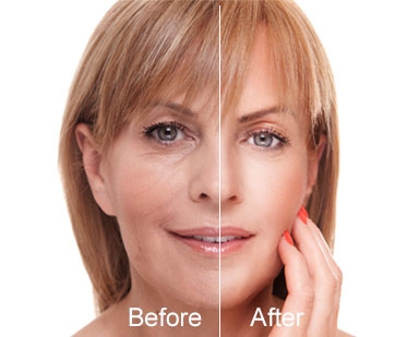 face and neck cosmetic procedures denver
